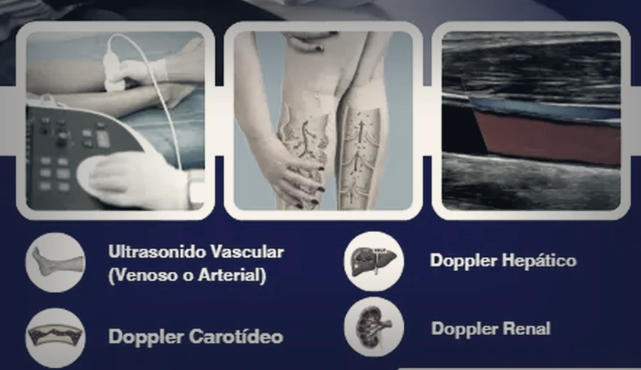 Ultrasonido Doppler