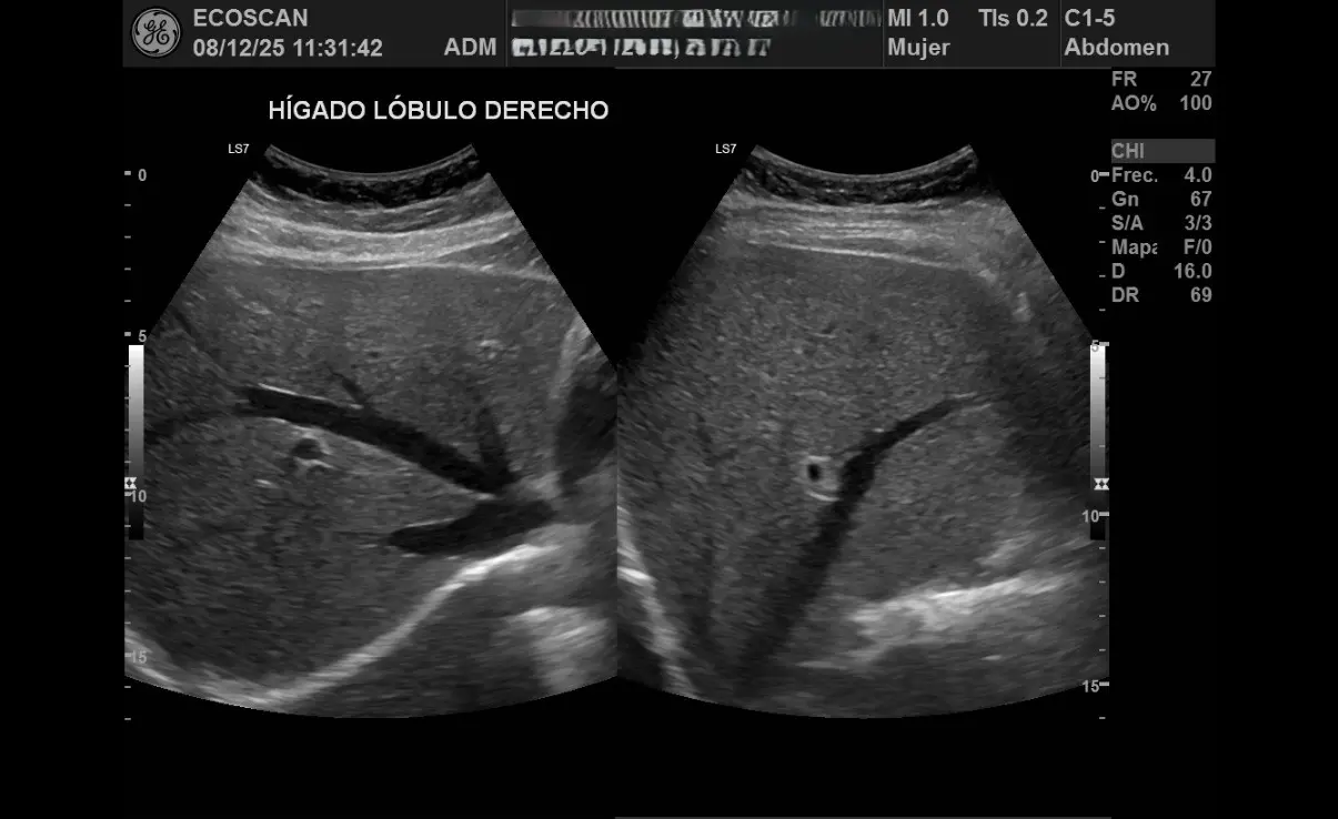 Ultrasonido abdominal en EcoScan León