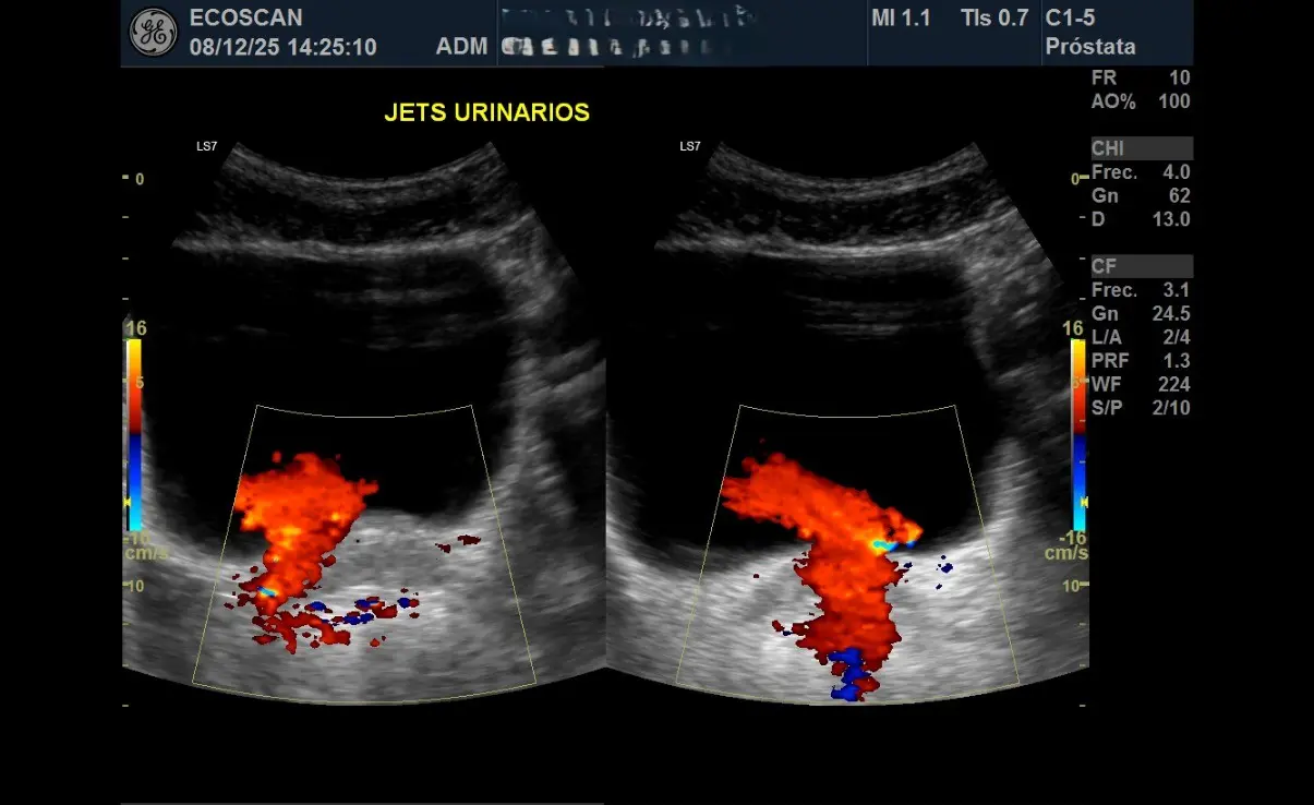 Ultrasonido abdominal en EcoScan León