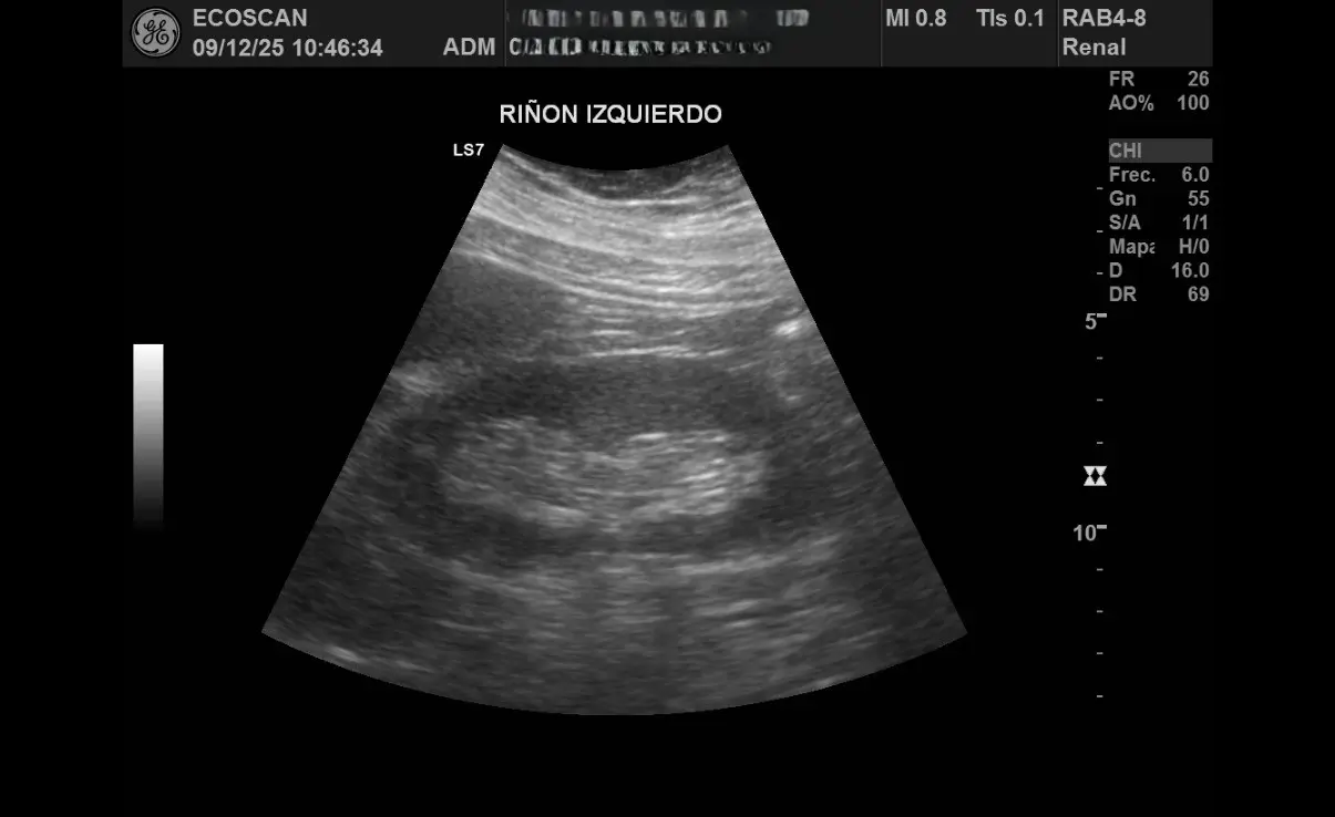 Ultrasonido abdominal en EcoScan León