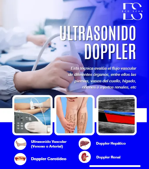 Ultrasonido Doppler en EcoScan León