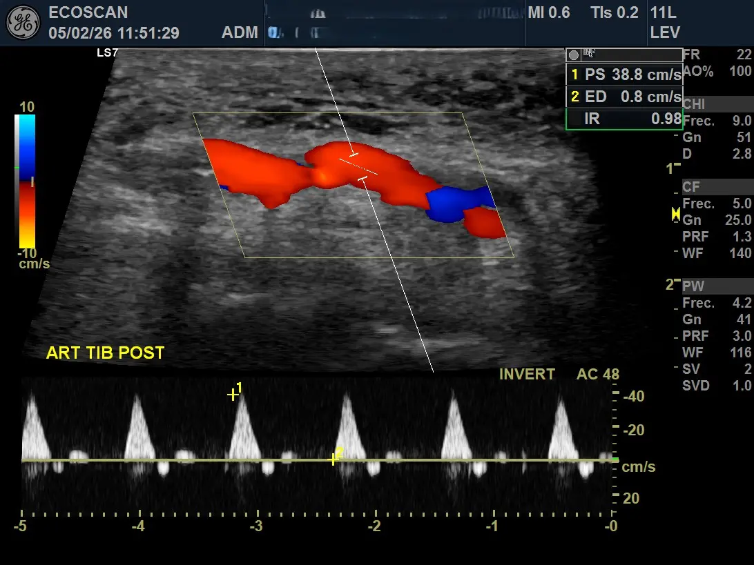 Ultrasonido Doppler en EcoScan León