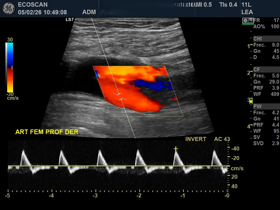 Ultrasonido Doppler en EcoScan León