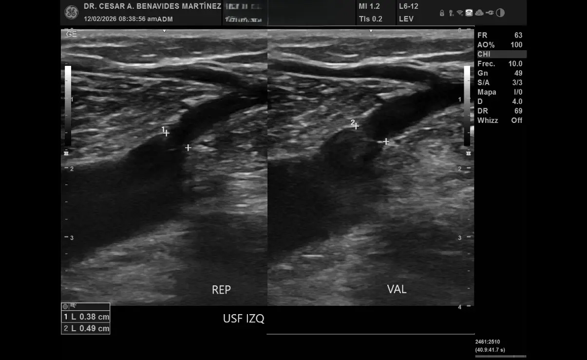 Ultrasonido Doppler en EcoScan León