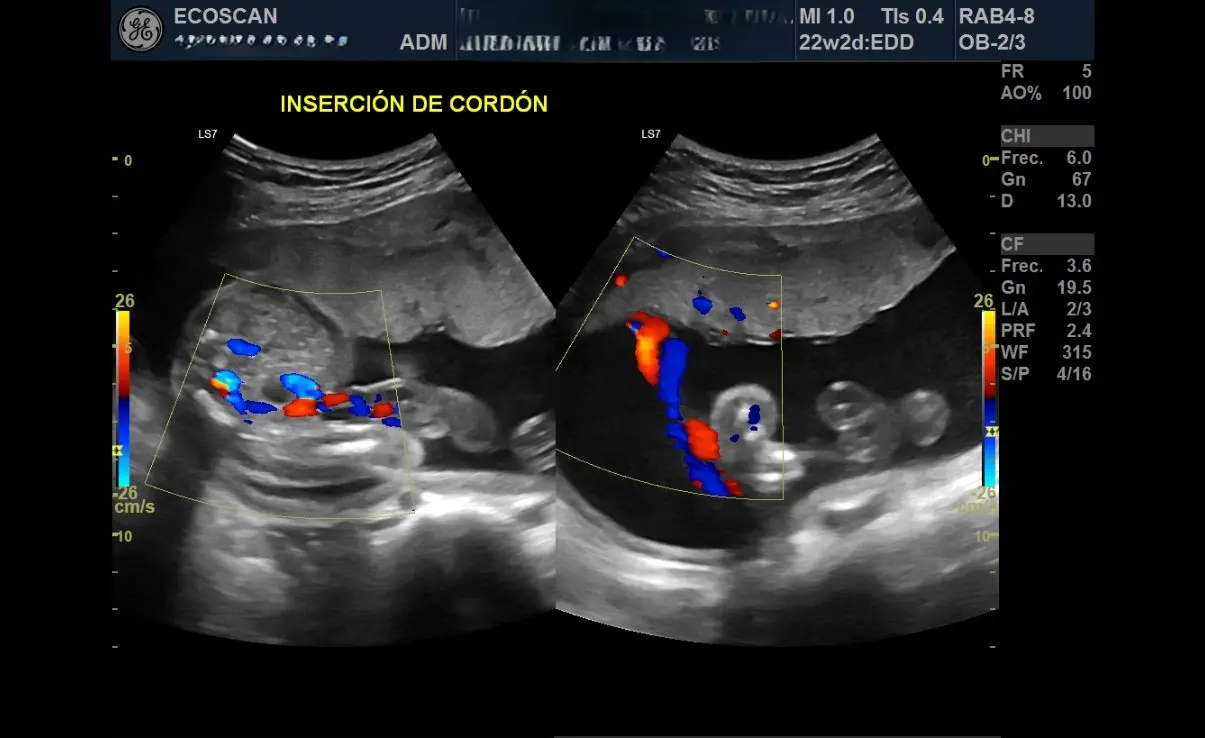 Ultrasonido obstétrico 4D en EcoScan León
