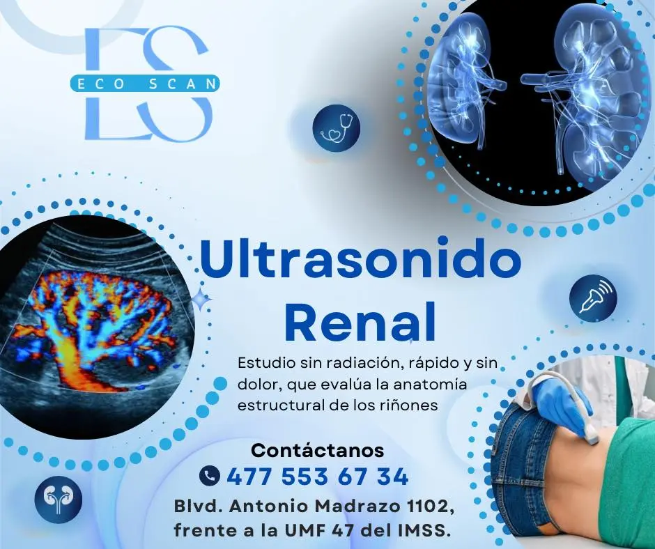 Ultrasonido renal en EcoScan León