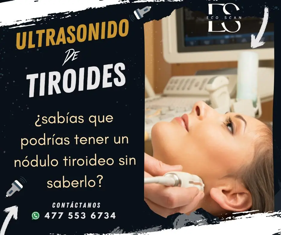 Ultrasonido tiroideo en EcoScan León