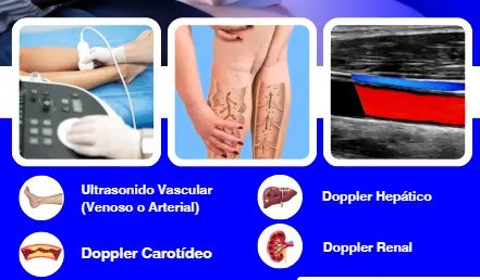 Imagen ilustrativa de ultrasonido Doppler arterial, venoso y obstétrico
